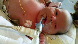 Sự sống thần kỳ của em bé có nước trong cơ thể thay vì máu